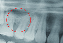 電腦影像模擬合併導航系統    有效提高手術效率和精確度(相關圖片)