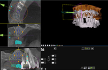 電腦影像模擬合併導航系統    有效提高手術效率和精確度(相關圖片)