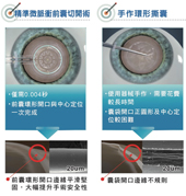 白內障手術新科技    Zepto引導視軸中心定位前囊切口術(相關圖片)
