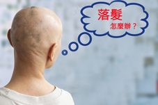 認識圓禿  重拾自信心(相關圖片)