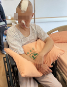 中醫針灸助顱腦外傷患者重拾希望(相關圖片)