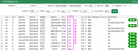 骨質疏鬆不可怕     AI幫你顧骨本(相關圖片)
