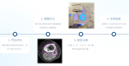 告別關節痛的新解方  低劑量放射治療助您重獲行動力(相關圖片)