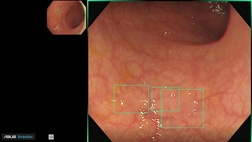 AI讓醫療更精準    科技守護您的腸道健康(相關圖片)