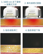 非侵入式體雕新選擇  體外雷射溶脂機器  安全、舒適、無恢復期的局部雕塑科技(相關圖片)