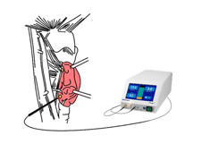 創新副甲狀腺偵測技術  引領甲狀腺手術新時代(相關圖片)