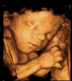 最新『4D彩色立體超音波儀器』	 腹胎檢查利器(相關圖片)