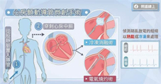 安全精準進行心臟介入手術的新武器  心臟內超音波(相關圖片)