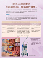 妳有婦女泌尿的困擾嗎？   有效改善尿失禁的「陰道雷射治療」(相關圖片)