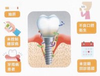 植牙  能一勞永逸嗎?(相關圖片)