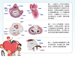 談退化性僧帽瓣逆流及修復手術(相關圖片)