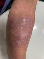 皮膚科醫師解說 七招維護肌膚健康小秘訣(相關圖片)