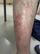 皮膚科醫師解說 七招維護肌膚健康小秘訣(相關圖片)