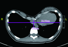 剖析小兒外科常見疾病(相關圖片)