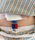 新北市護理師護士公會2023年護理創新競賽獎(第二名及第三名)(相關圖片)