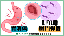 搞懂胃潰瘍與胃食道逆流  專科醫師全解析(相關圖片)