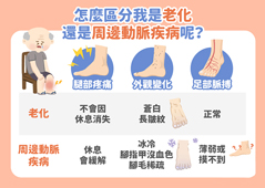 了解周邊動脈疾病與日常保健(相關圖片)