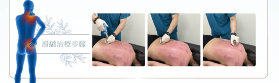 全方位筋膜放鬆(相關圖片)