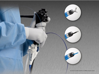  導管膽胰內視鏡  精準影像取樣不遺漏  (相關圖片)