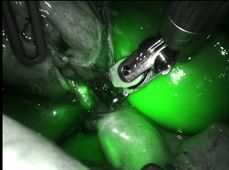 從一場腹痛開始   創傷科團隊與機械手臂的精準革命(相關圖片)