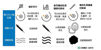 真空吸引乳房切片系統  兼具診斷效率與美觀  (相關圖片)