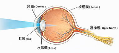年輕失明的警訊  雷伯氏遺傳性視神經病變(相關圖片)