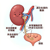 腎臟移植 從透析到重生的一條路(相關圖片)