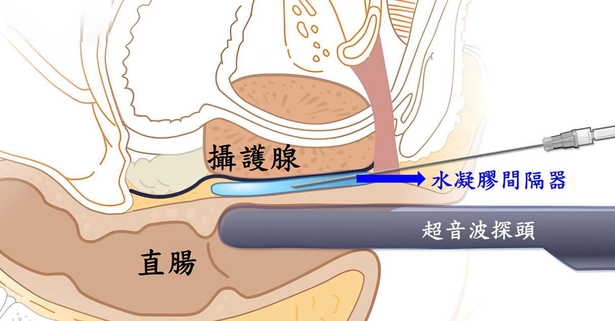訊息內文照片