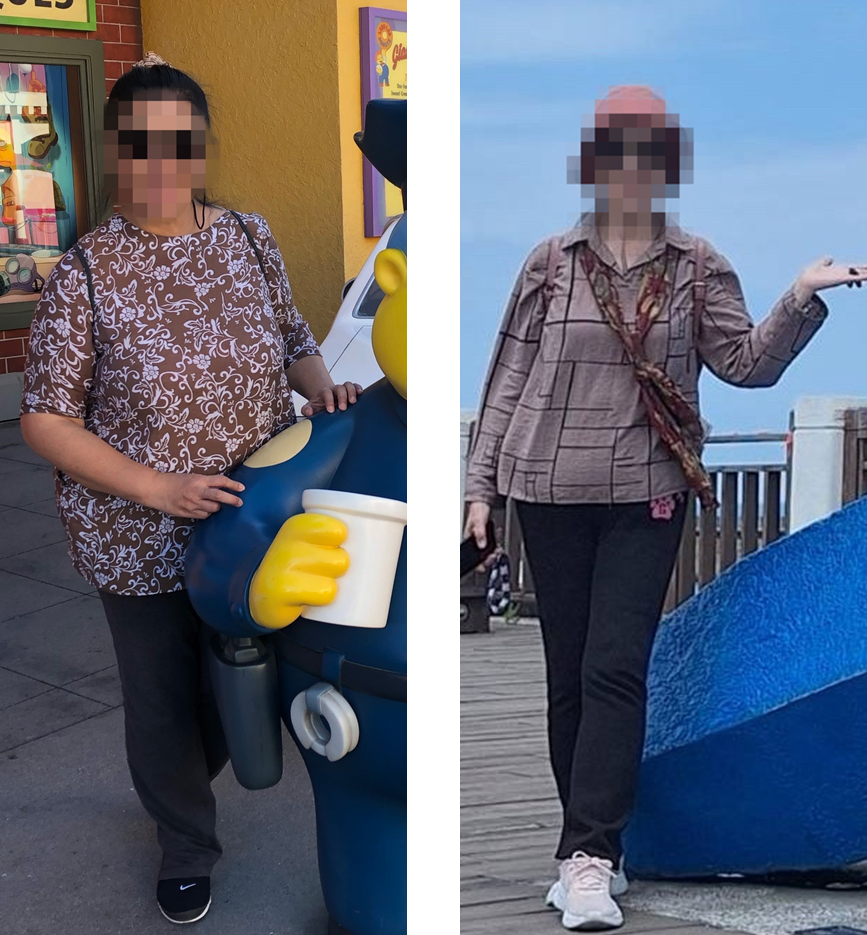 260907張女士接受縮胃繞腸手術