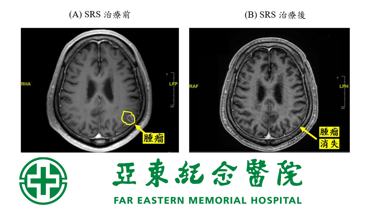 訊息內文照片