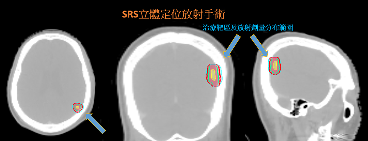 訊息內文照片