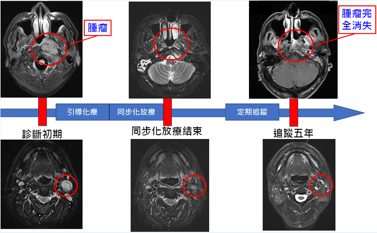 訊息內文照片