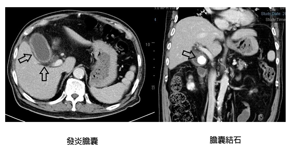 公告插圖格式 - 醫療新聞