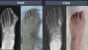 PIC