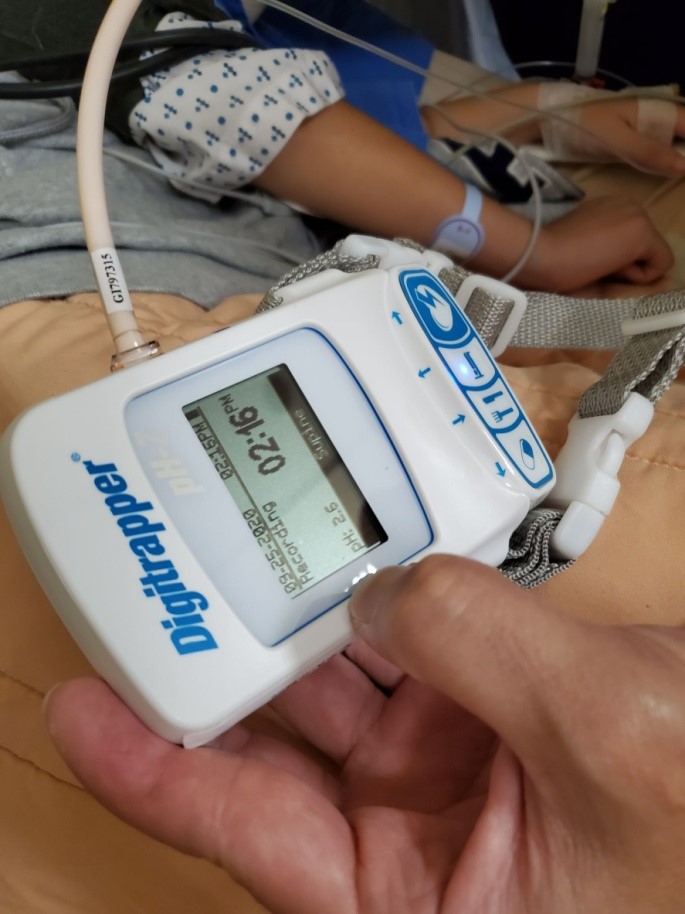 二十四小時食道酸鹼值測定