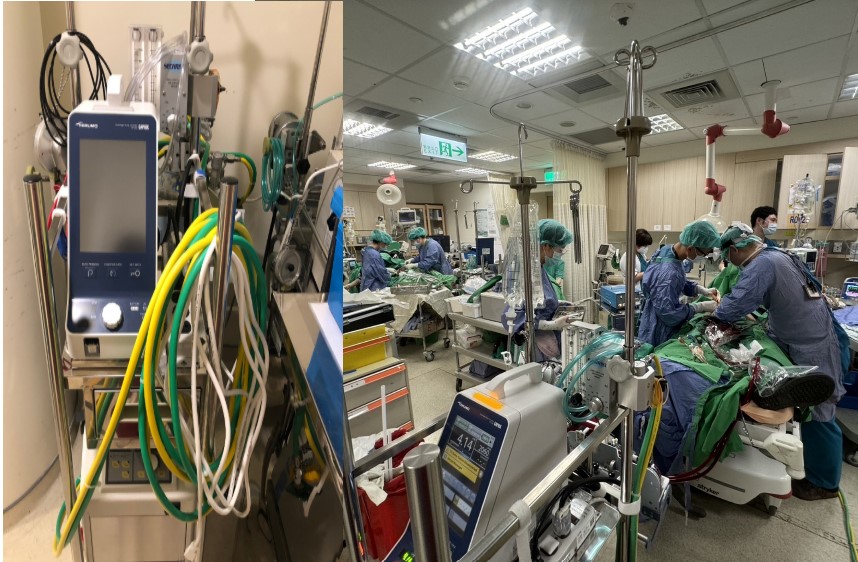 葉克膜—體外維生系統